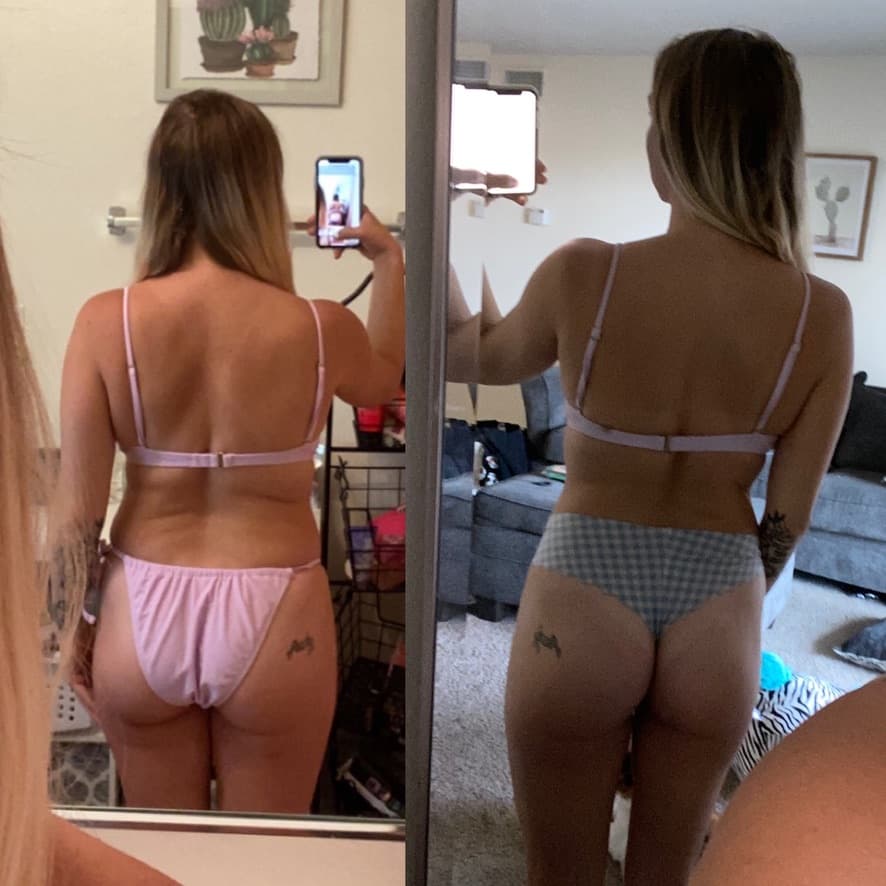 Atlas patient transformation 5